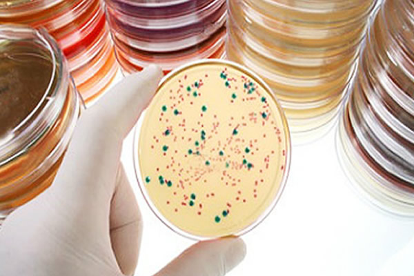 Identificacion Serologicade Germenes